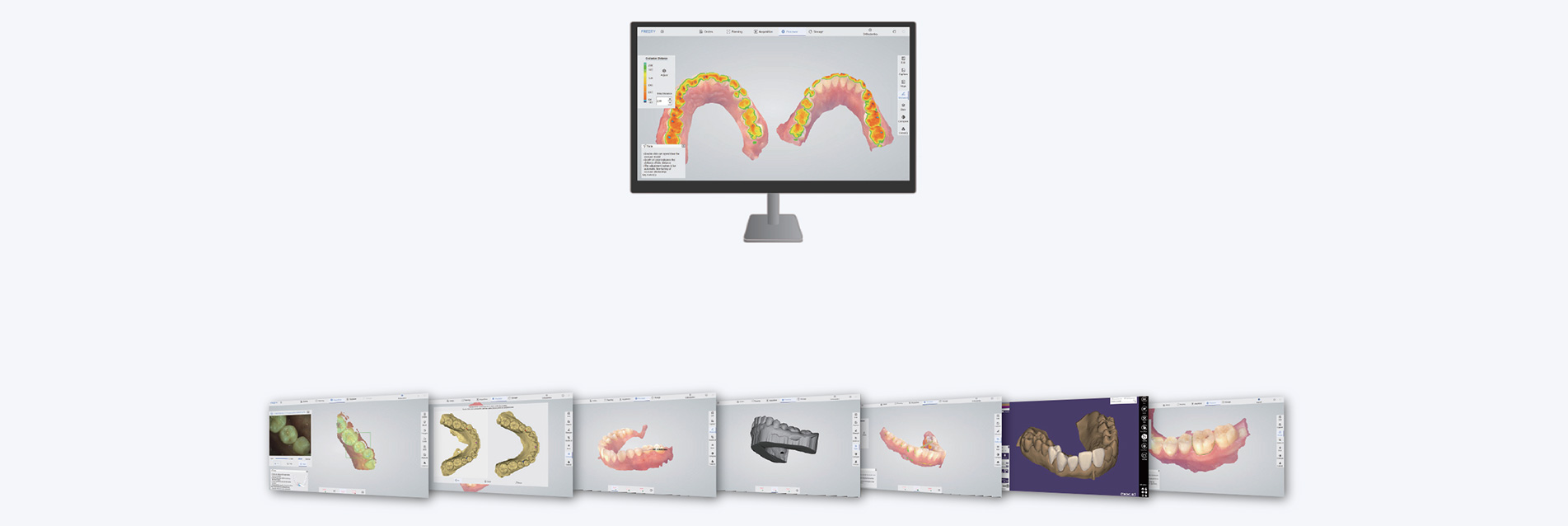 3D Digital Intraoral Scanner